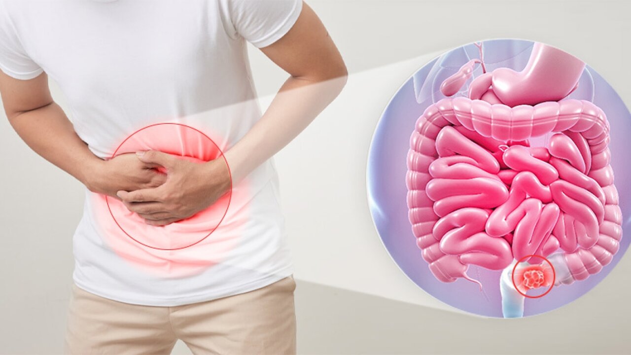تحقیقات جدید: ارتباط بین روده و مغز در بروز یبوست مزمن